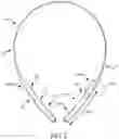 Fig. 03 - Headphone earcup mount in continuous headband-spring headphone system