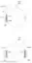Fig. 01 - Hearing device comprising a speech presence probability estimator