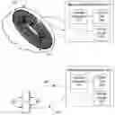 Fig. 01 - METHODS AND DEVICES FOR TREATING PRIMARY HEADACHE