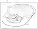 Fig. 01 - Method of fabricating an electronic medical device, including overmolding an assembly with thermoplastic material