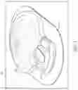 Fig. 02 - Method of fabricating an electronic medical device, including overmolding an assembly with thermoplastic material