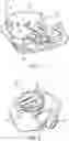 Fig. 04 - Method of fabricating an electronic medical device, including overmolding an assembly with thermoplastic material