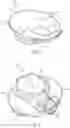 Fig. 06 - Method of fabricating an electronic medical device, including overmolding an assembly with thermoplastic material