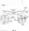 Fig. 03 - Heat management device and method of manufacture