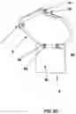 Fig. 04 - Urine Deflector