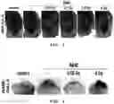 Fig. 02 - Method for alleviating phenotype of degenerative disease model by using low-dose radiation