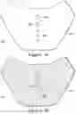 Fig. 17 - Apparel with selectively attachable and detachable elements
