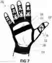 Fig. 05 - Protective device for human joint