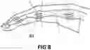 Fig. 06 - Protective device for human joint
