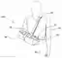Fig. 02 - Shoulder sling and pillow system