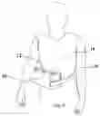 Fig. 03 - Shoulder sling and pillow system