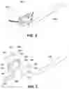 Fig. 02 - Device for assisted teeth cleaning