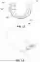 Fig. 11 - Device for assisted teeth cleaning