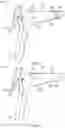 Fig. 03 - Applicator for a speculum accessory sleeve and use thereof