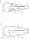 Fig. 05 - Applicator for a speculum accessory sleeve and use thereof