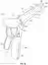 Fig. 07 - Applicator for a speculum accessory sleeve and use thereof