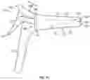 Fig. 08 - Applicator for a speculum accessory sleeve and use thereof