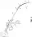 Fig. 10 - Portable endoscope system