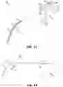Fig. 12 - Portable endoscope system