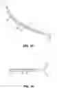 Fig. 13 - Portable endoscope system