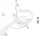 Fig. 40 - Portable endoscope system