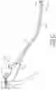 Fig. 12 - Endoscope With Inspection Accessory and Inspection Accessory for the Same