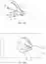 Fig. 22 - DELIVERY OF BIOLOGICAL COMPOUNDS TO ISCHEMIC AND/OR INFARCTED TISSUE