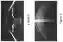 Fig. 04 - Procedural optical coherence tomography (OCT) for surgery and related methods