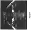 Fig. 05 - Procedural optical coherence tomography (OCT) for surgery and related methods
