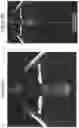 Fig. 06 - Procedural optical coherence tomography (OCT) for surgery and related methods