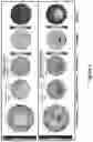 Fig. 02 - Diagnostic classification of corneal shape abnormalities
