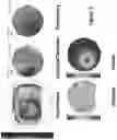 Fig. 04 - Diagnostic classification of corneal shape abnormalities