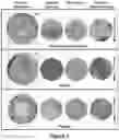 Fig. 07 - Diagnostic classification of corneal shape abnormalities