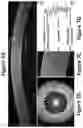 Fig. 08 - Diagnostic classification of corneal shape abnormalities