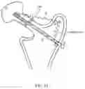 Fig. 08 - Method for detecting body parameters