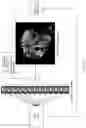 Fig. 05 - SYSTEM OF MACHINE-LEARNING MEDIATED IMAGE ANALYSIS TO AID PREDICTIVE MRI-GUIDED HYPERTHERMIA TREATMENTS