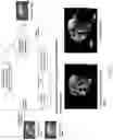 Fig. 07 - SYSTEM OF MACHINE-LEARNING MEDIATED IMAGE ANALYSIS TO AID PREDICTIVE MRI-GUIDED HYPERTHERMIA TREATMENTS