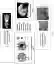 Fig. 08 - SYSTEM OF MACHINE-LEARNING MEDIATED IMAGE ANALYSIS TO AID PREDICTIVE MRI-GUIDED HYPERTHERMIA TREATMENTS
