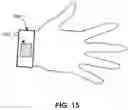 Fig. 22 - Estimation of peripheral vascular resistance using a miniature piezoelectric sensor