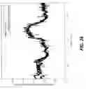 Fig. 32 - Estimation of peripheral vascular resistance using a miniature piezoelectric sensor
