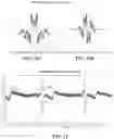 Fig. 10 - Non-invasive method and system for estimating arterial flow characteristics
