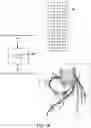 Fig. 15 - Non-invasive method and system for estimating arterial flow characteristics
