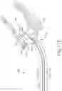 Fig. 16 - ENDOSCOPE WITH ANATOMY ELEVATION ASSEMBLY