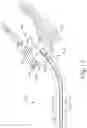 Fig. 17 - ENDOSCOPE WITH ANATOMY ELEVATION ASSEMBLY