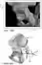 Fig. 16 - Systems and methods for intra-operative pelvic registration