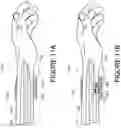 Fig. 13 - Physiological measurement using wearable device
