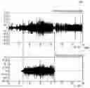 Fig. 01 - Method, system and non-transitory computer-readable recording medium for calculating information relating to urination