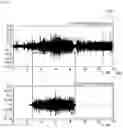 Fig. 03 - Method, system and non-transitory computer-readable recording medium for calculating information relating to urination