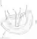 Fig. 04 - Fluoroscopy operator protection device