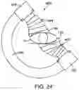 Fig. 24 - Fluoroscopy operator protection device
